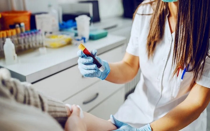      Lipoproteina (a). Normy, badanie i przyczyny podwyższonego wyniku        