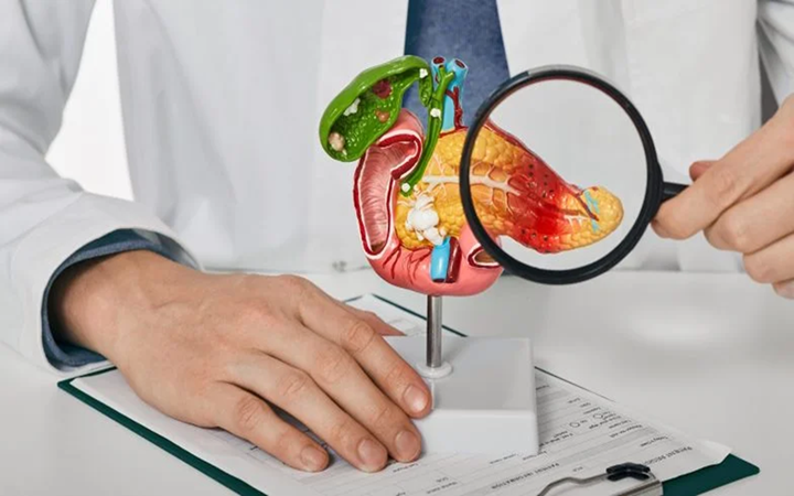  Nowy lek na raka trzustki. Rasonque zatwierdzony przez FDA    