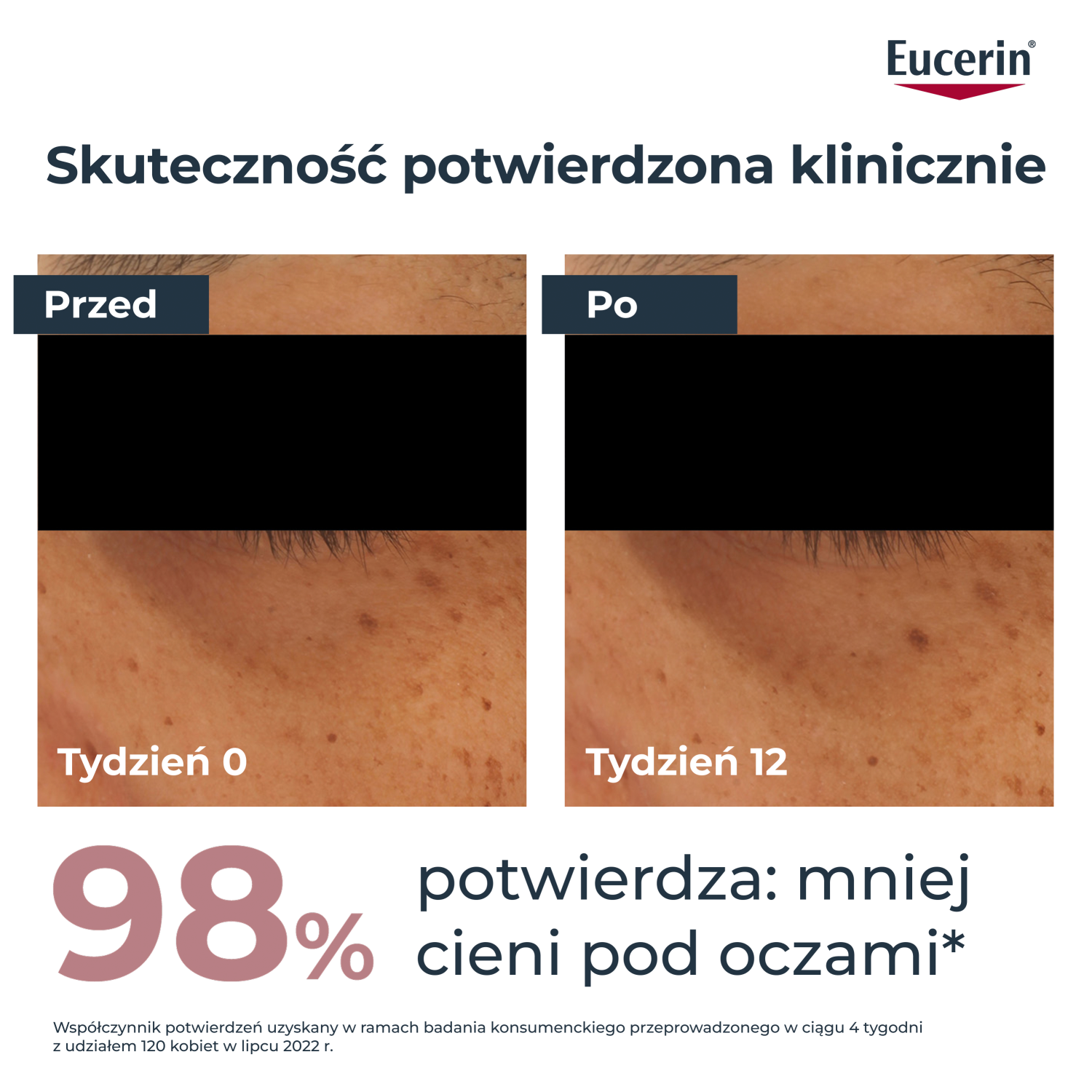Набор Eucerin Anti-Pigment: крем для кожи вокруг глаз 15 мл и дневной крем для лица SPF 30 20 мл — фото 5