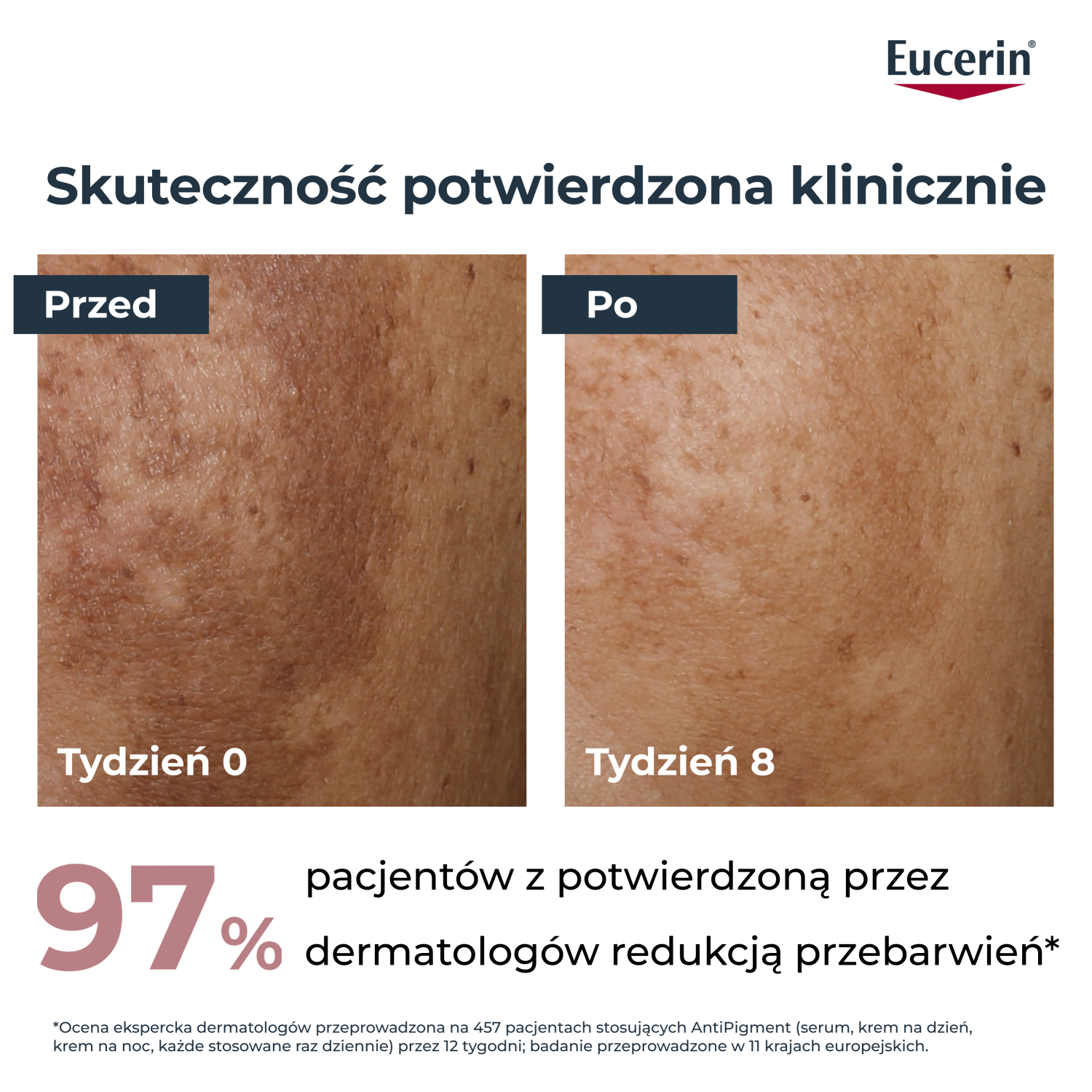 Набор Eucerin Anti-Pigment: дневной крем против пигментации SPF 30 50 мл и дневной крем SPF 30 20 мл — фото 5