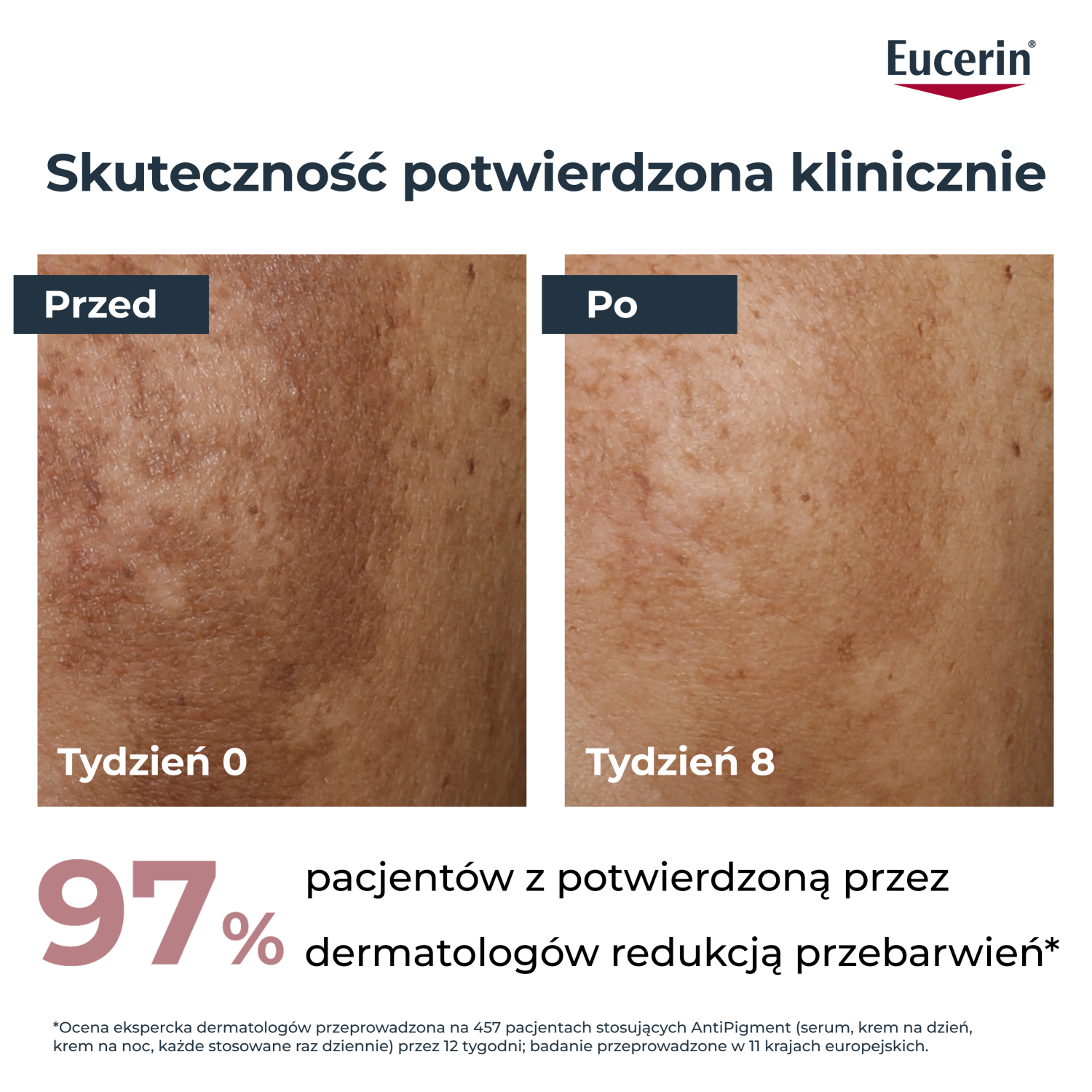 Ночной крем для лица Eucerin Anti-Pigment против пигментации, с тиамидолом, 50 мл и косметичка — фото 4