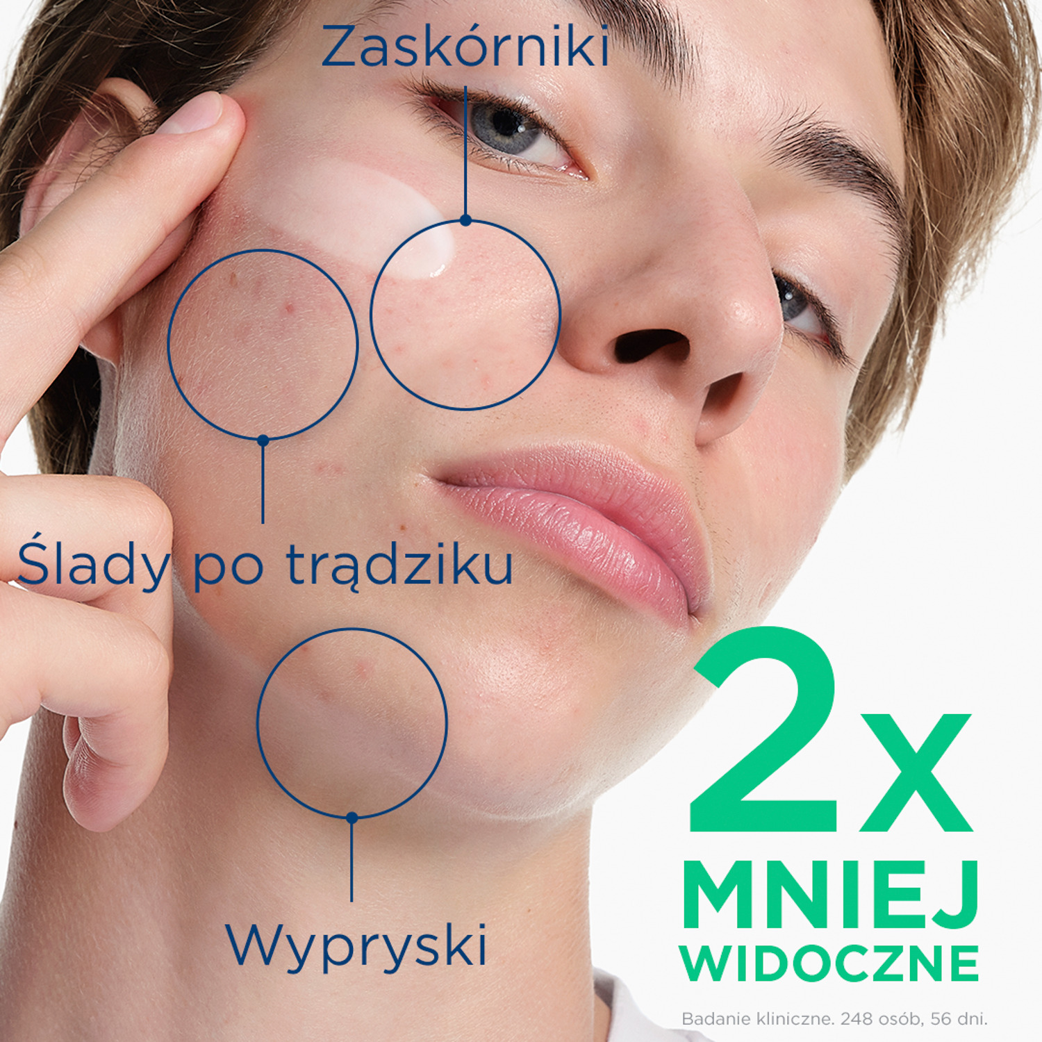 Набор Bioderma: гель-крем Sebium Kerato+ против несовершенств 30 мл и миниатюры Hydrabio — фото 3