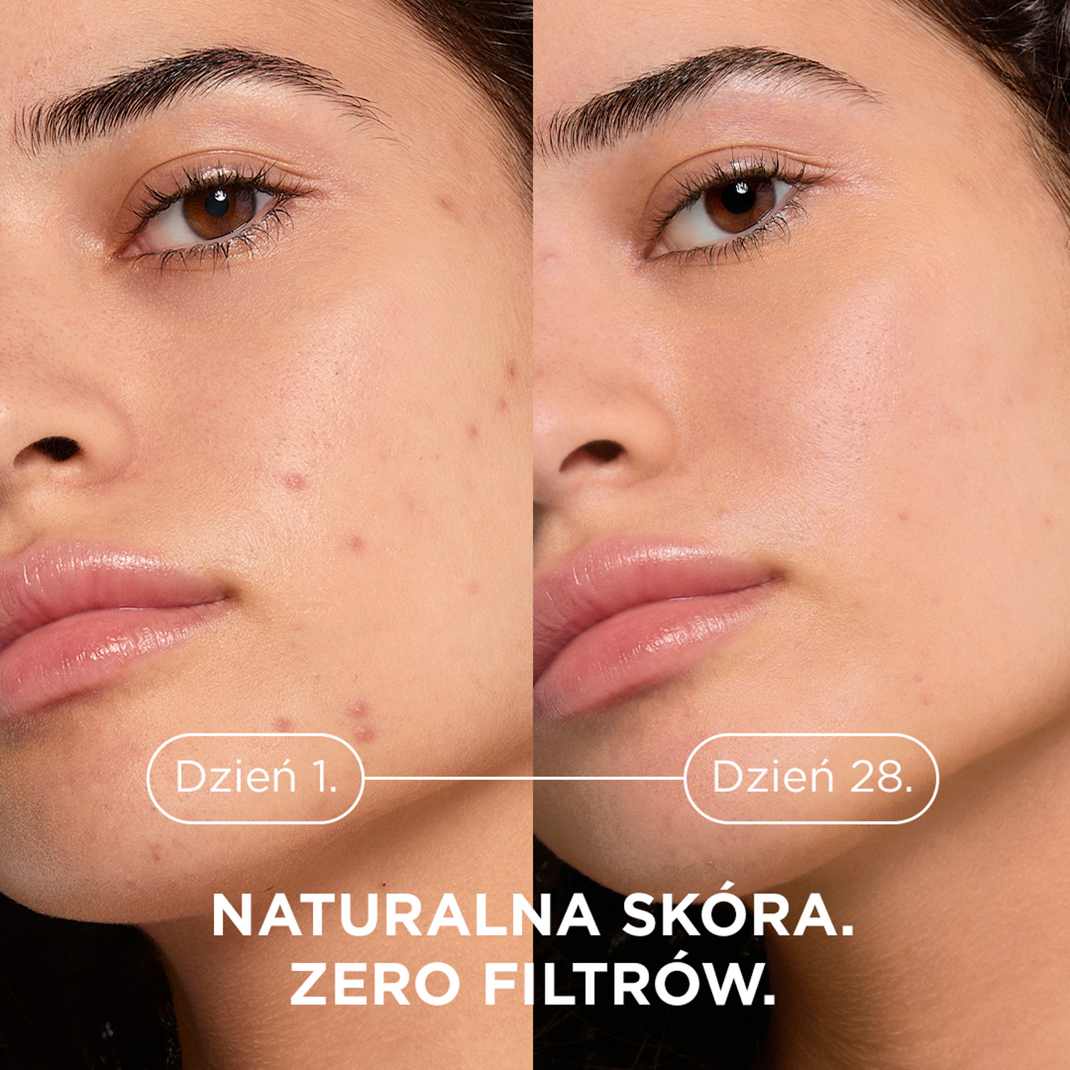 Набор Bioderma: гель-крем Sebium Kerato+ против несовершенств 30 мл и миниатюры Hydrabio — фото 4