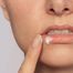 Allergika, balsam do ust, 15 ml - miniaturka 3 zdjęcia produktu