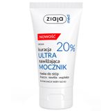 Ziaja Med Kuracja Ultranawilżająca, maska do stóp na dysfunkcje skóry suchej, mocznik 20%, 75 ml - miniaturka zdjęcia produktu